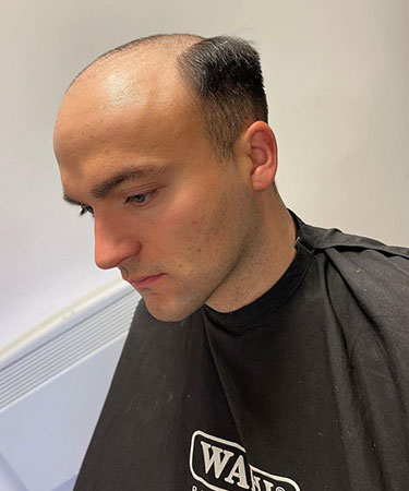 Hair Replacement for Men Service at Image London Salons